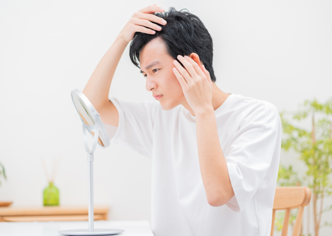 髪の毛に悩む男性 写真